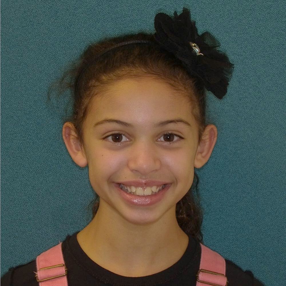 Young child smiling in the orthodontic chair during an early screening
