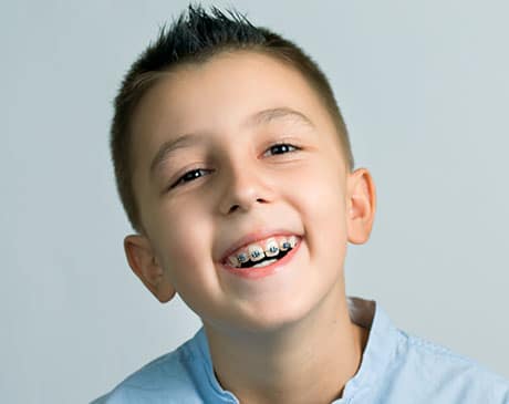Smiling boy with braces wearing blue shirt