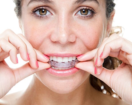 Woman wearing clear dental aligners