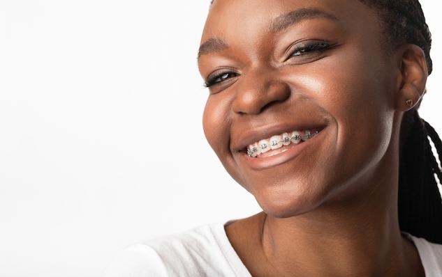 weigh your options on different types of braces