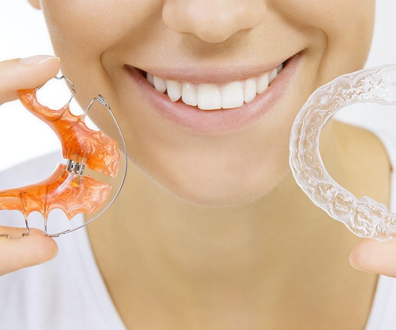 Beautiful smiling girl holding retainer for teeth (dental braces) and individual tooth tray