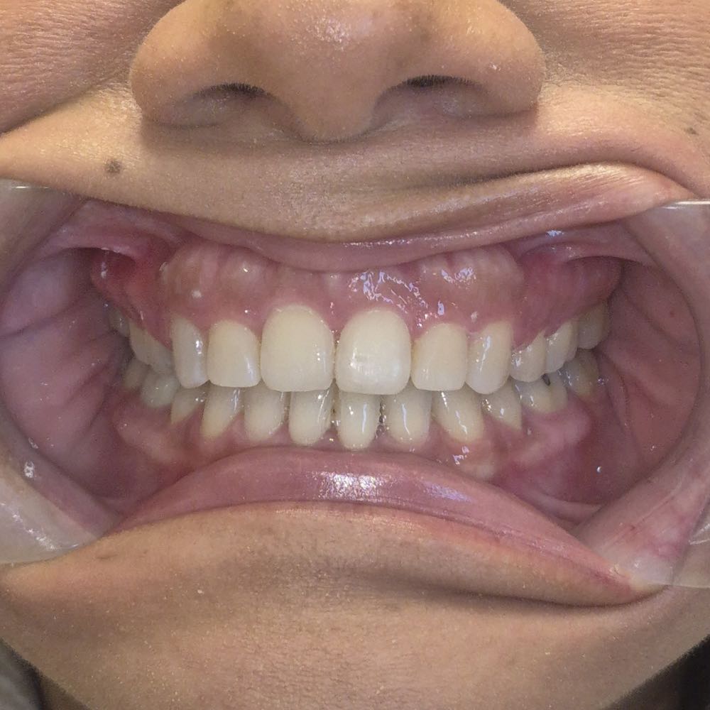 Close-up of a healthy smile showing teeth and gums