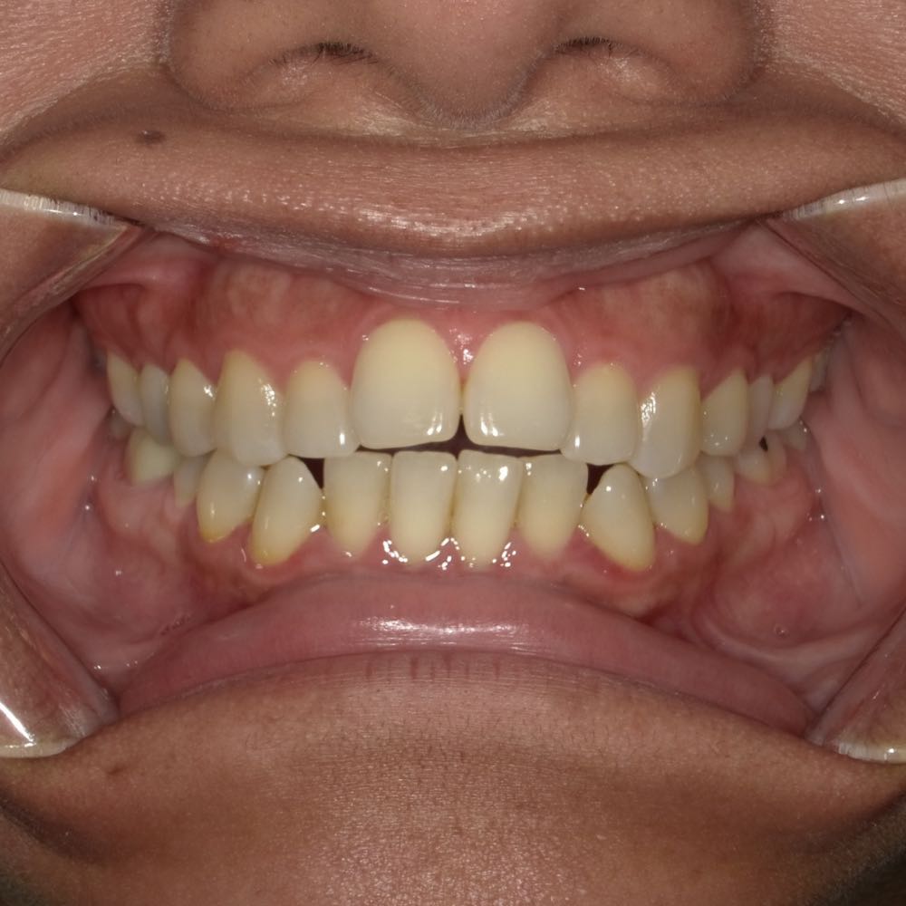 Close-up of a smiling person showing teeth