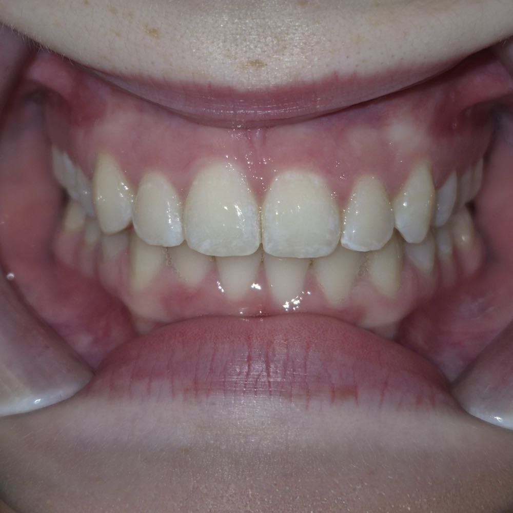 Close-up of a healthy human smile showing teeth