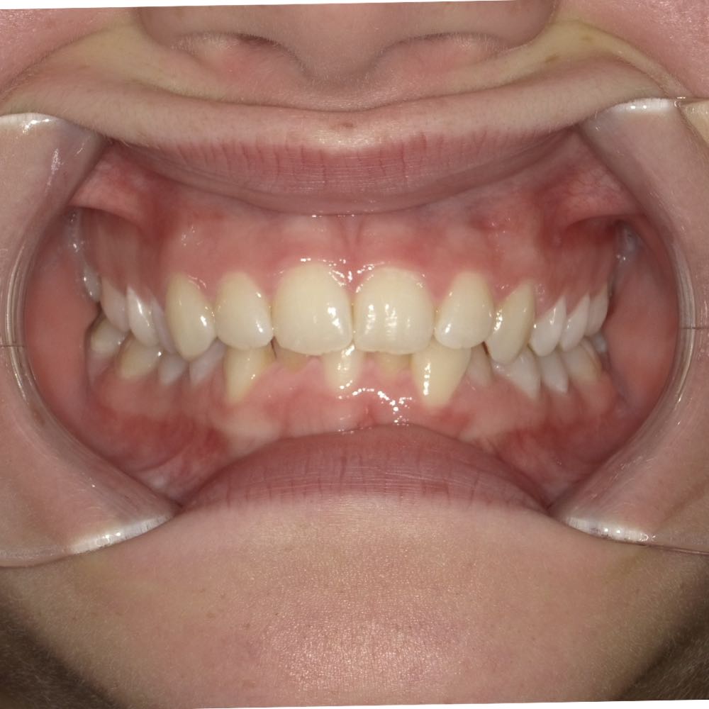 Close-up of a healthy human mouth open showing teeth