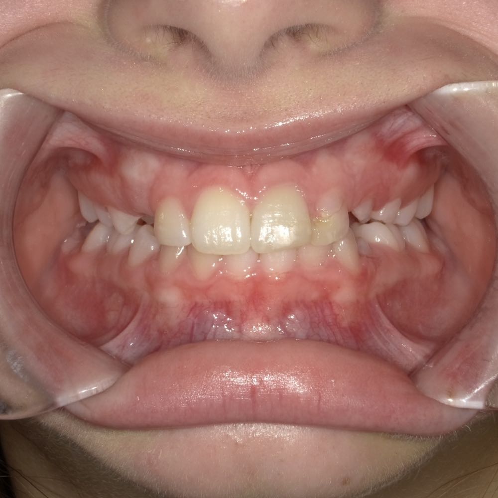 Close-up of child's teeth showing dental health