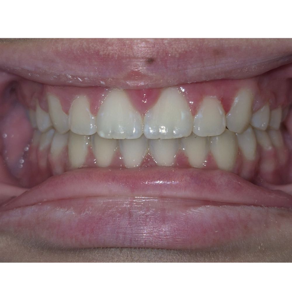 Close-up of a healthy human smile showing teeth