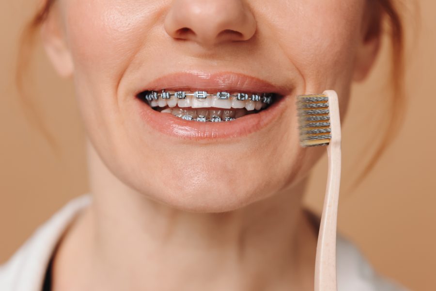 payment plans for braces